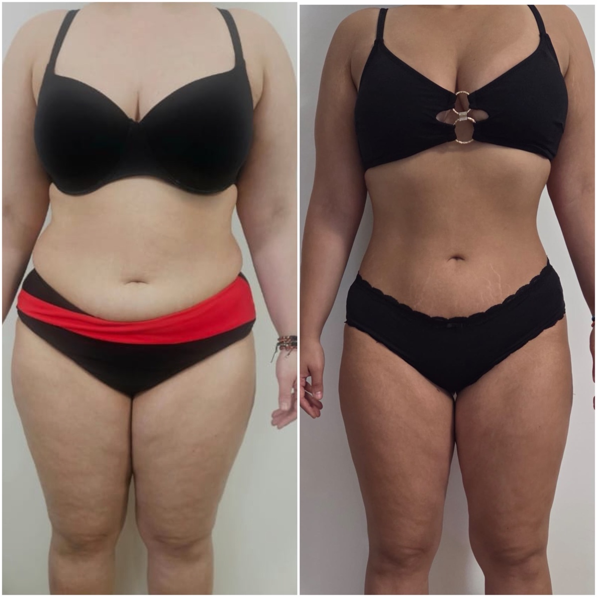 Transformare înainte și după a unei cliente Change Yourself For Life