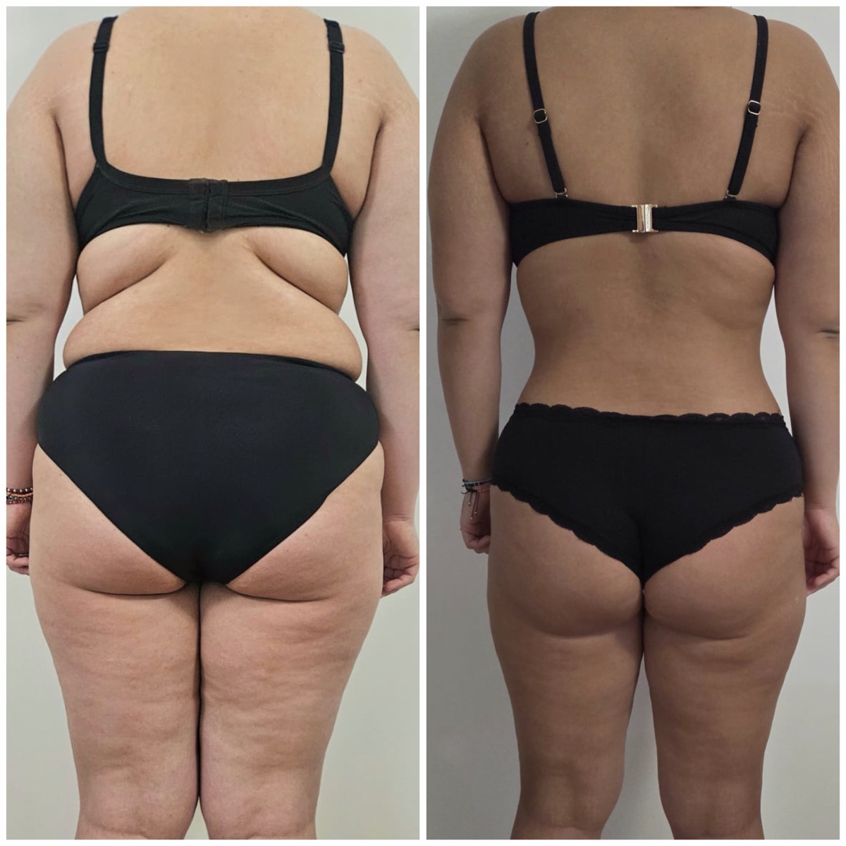 Transformare înainte și după a unei cliente Change Yourself For Life